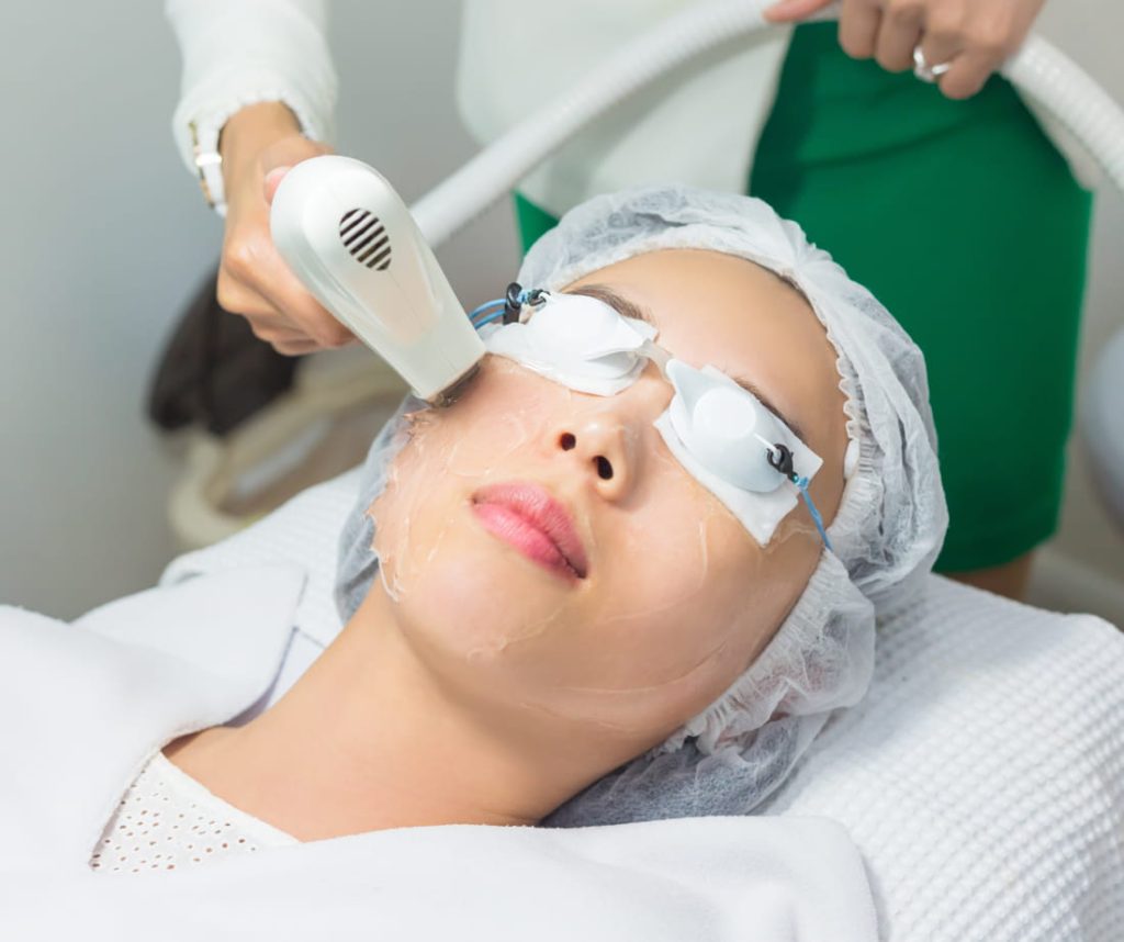 Ipl Treatments