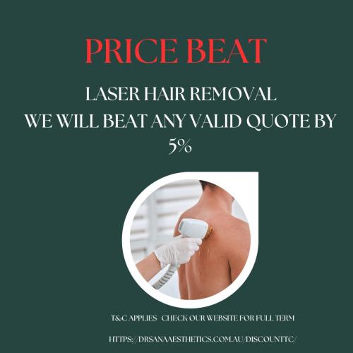 Price-beat-Laser